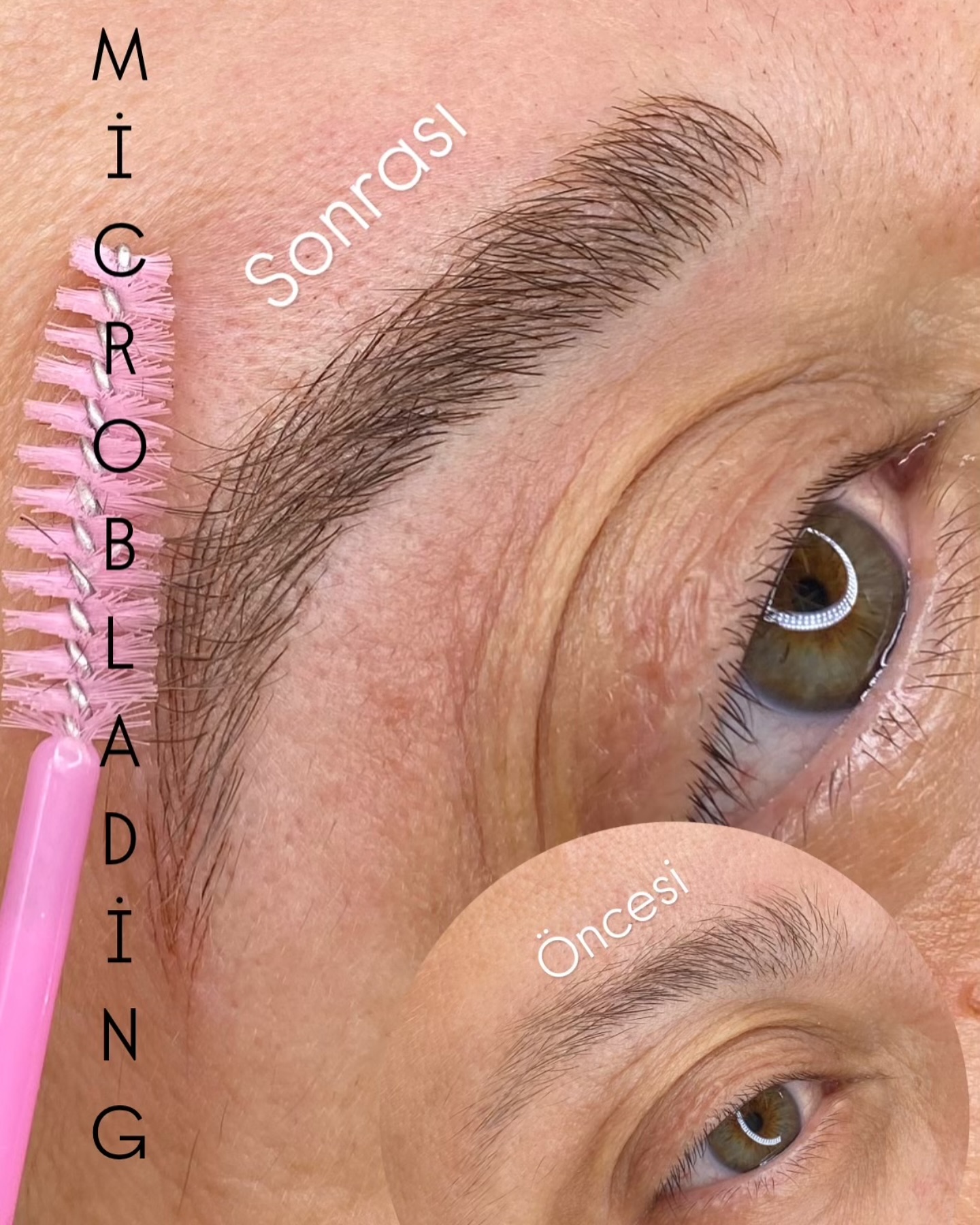 Microblading